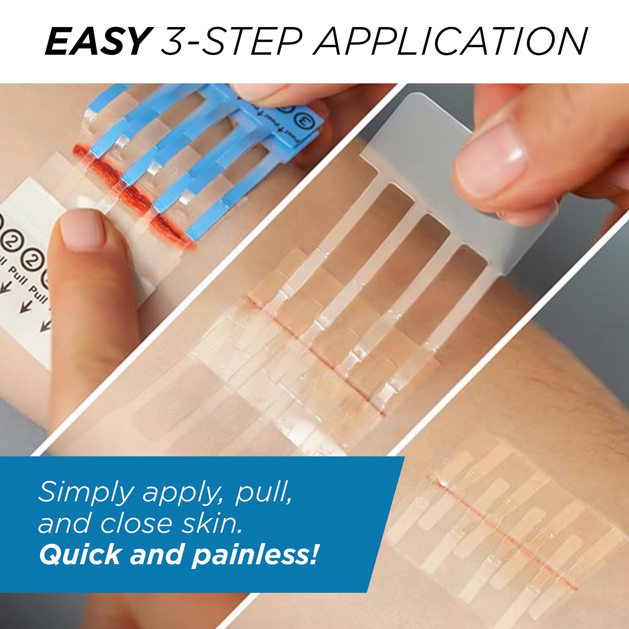 Clozex Emergency Laceration Kit - Repair Wounds Without Stitches, Skin Closure Device for a Wound Up to 1 1/2 Inches Length. Com