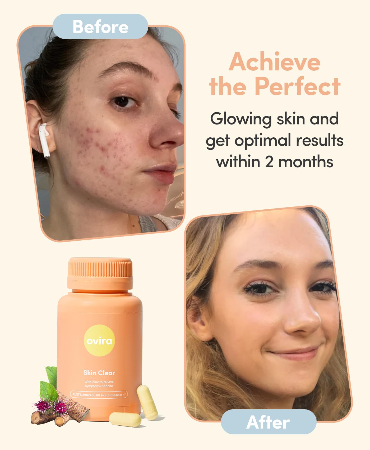 Ovira Skin Clear with ZINCBRIGHT - 60 Capsules for Clear and Glowing Skin | Rosacea & Hormonal Acne Treatment | Support Collagen