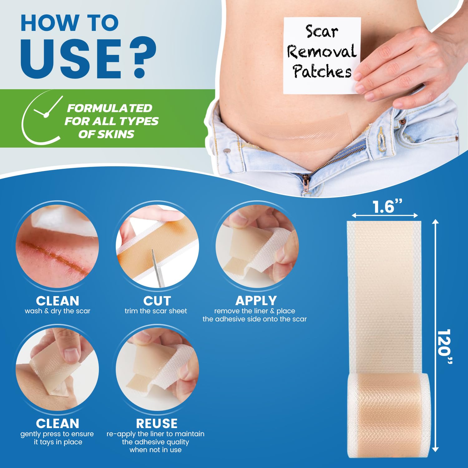 Silicone Scar Sheets,Silicone Scar Tape, (1.6    x 60    Roll, 1.5M) Scar Removal Strips for Surgical Scars,Keloids, C-Section,
