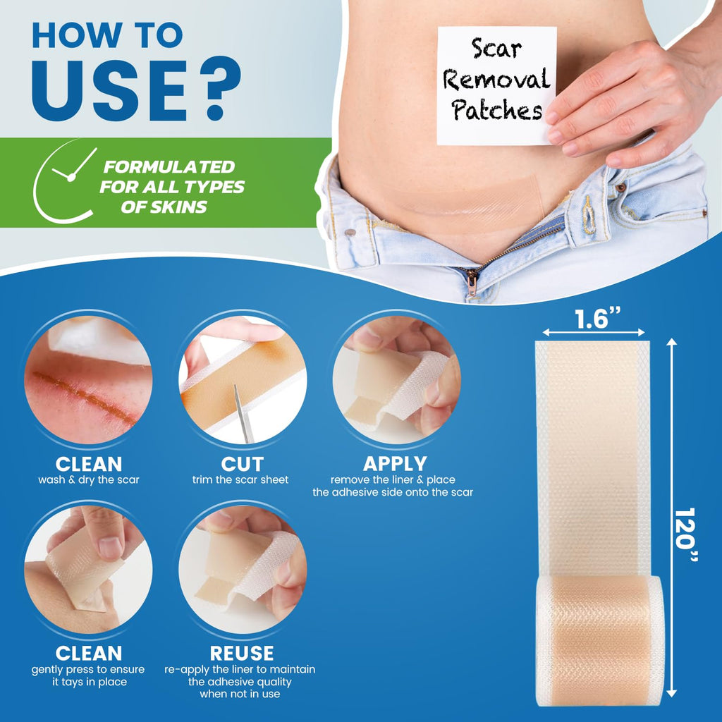 Silicone Scar Sheets,Silicone Scar Tape, (1.6    x 60    Roll, 1.5M) Scar Removal Strips for Surgical Scars,Keloids, C-Section,
