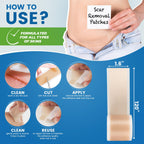Silicone Scar Sheets,Silicone Scar Tape, (1.6    x 60    Roll, 1.5M) Scar Removal Strips for Surgical Scars,Keloids, C-Section,