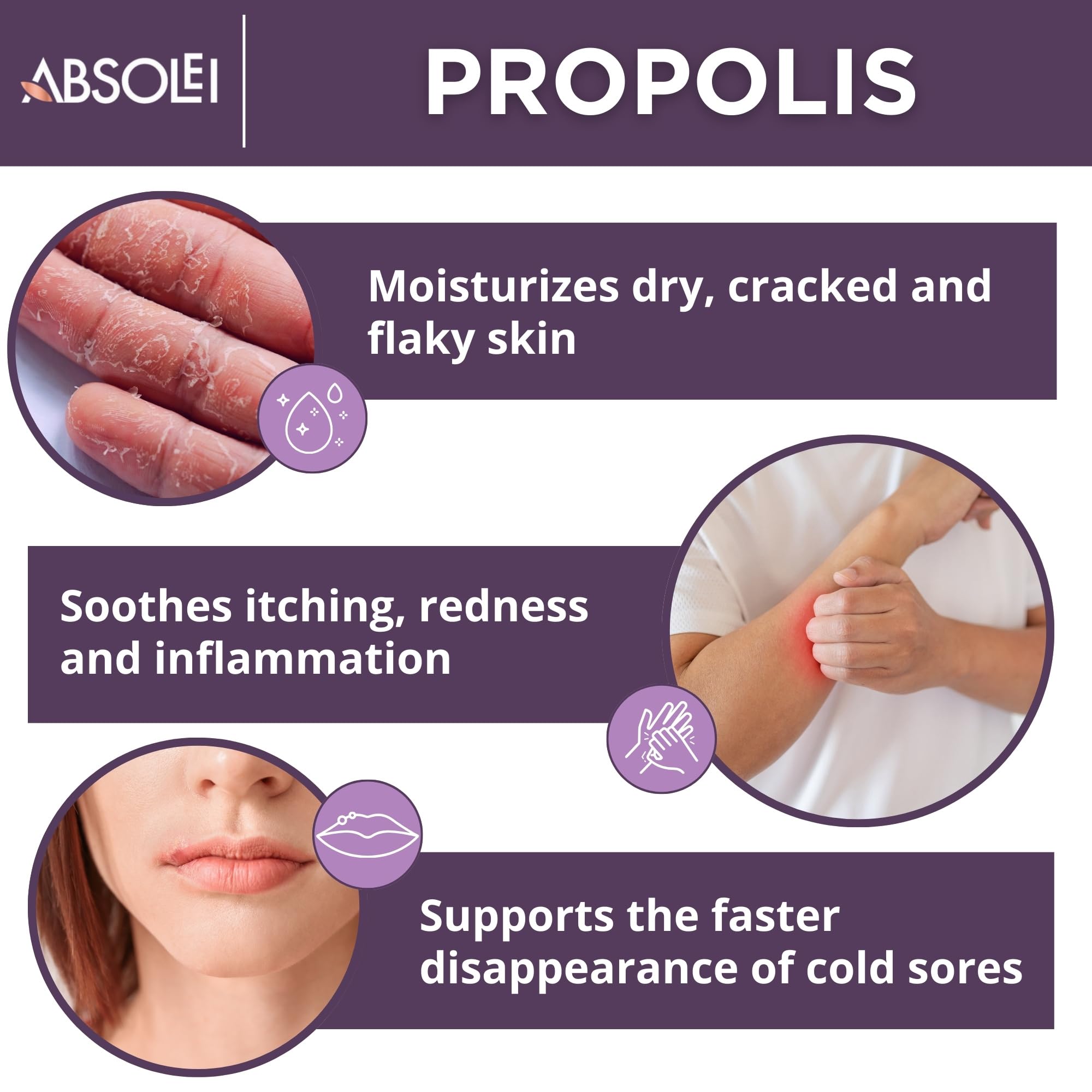 ABSOLEI Propolis Ointment, Natural 30% Propolis Ointment for Itchy, Dry and Cracked Skin, 1.35 fl oz