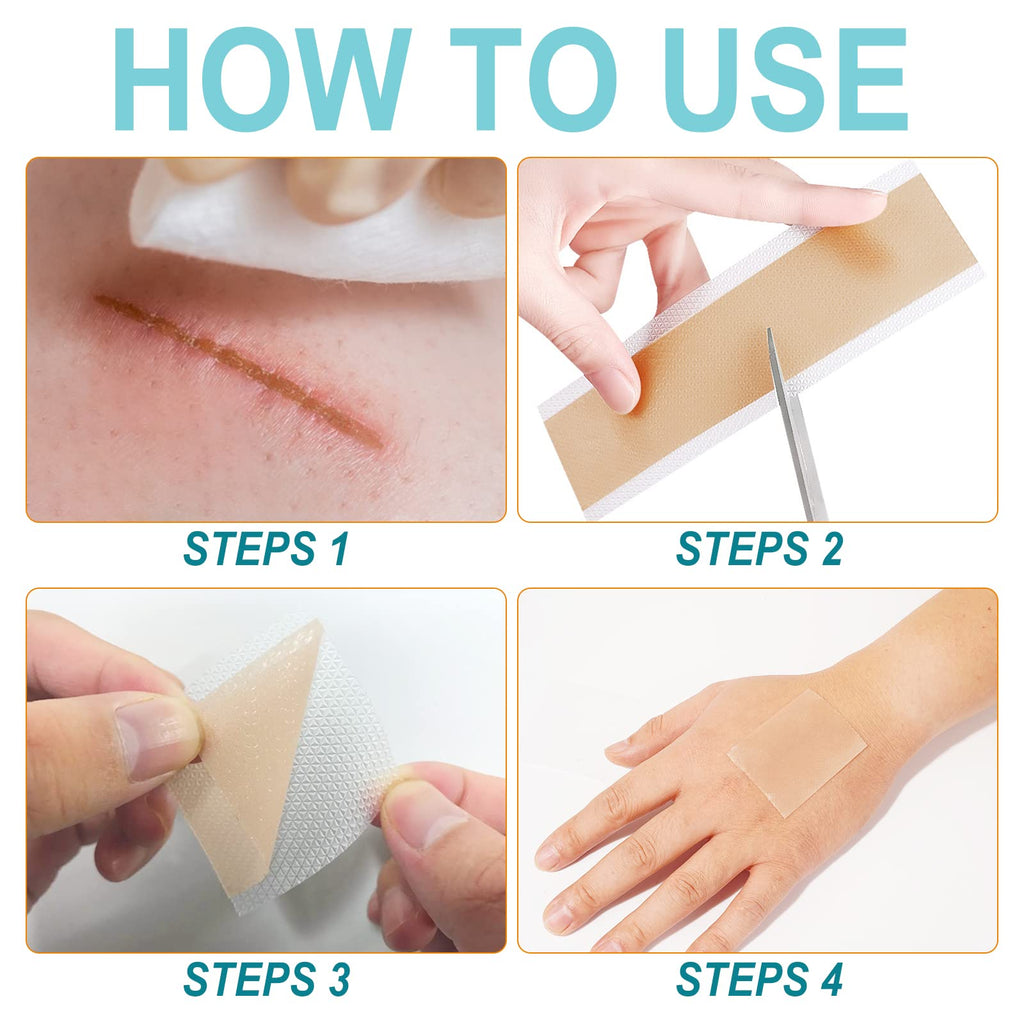 Silicone Scar Sheets (1.6    x 150   -3.8M), Medical Grade Soft Silicone Scar Tape, Strips, Roll - Keloid, C-Section, Surgical,