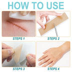 Silicone Scar Sheets (1.6    x 150   -3.8M), Medical Grade Soft Silicone Scar Tape, Strips, Roll - Keloid, C-Section, Surgical,
