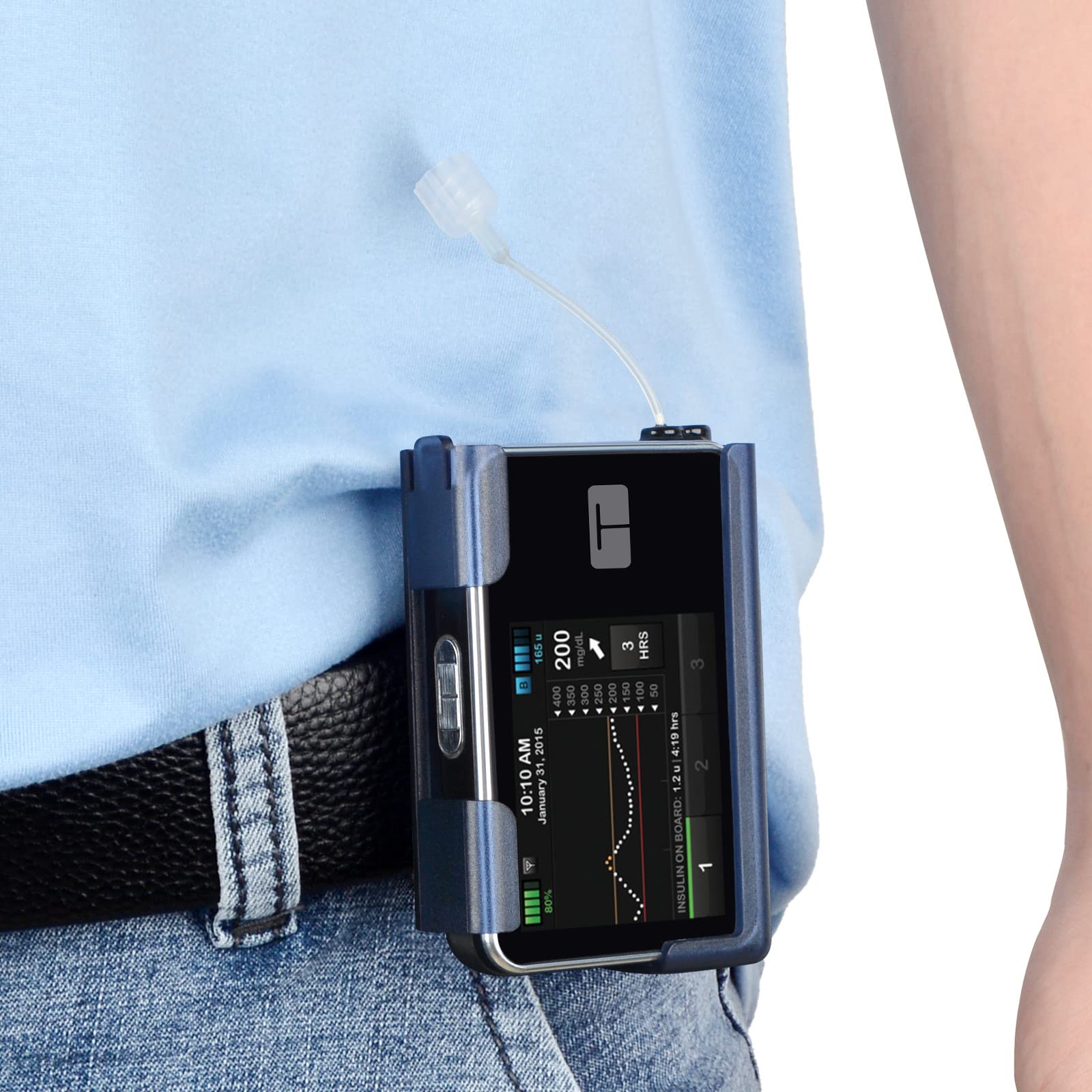 iGuerburn 360 Rotating Case for Tandem tslim X2, Insulin Pump Holder for t Slim/t:Slim G4, t: Holster Belt Clip Not Easy Fall & 