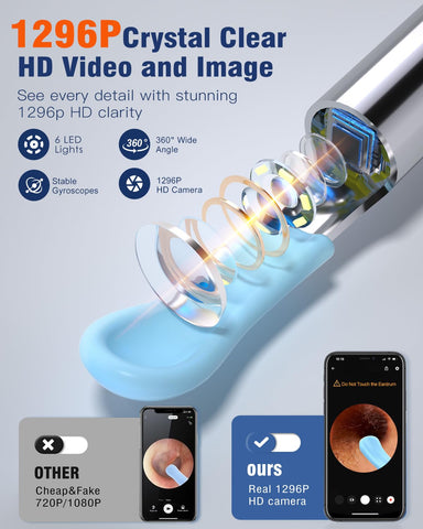 Ear Wax Removal, Ear Cleaning kit with 1296P Camera, Ear Camera with 6 LED Lights, Earwax Remover Tool for iPhone, iPad & Androi
