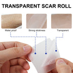 Silicone Scar Sheets (1.6    x 120   ), Clear Gel Silicone Scar Tape, Invisible Medical Grade Scar Silicone Strips, Transparent