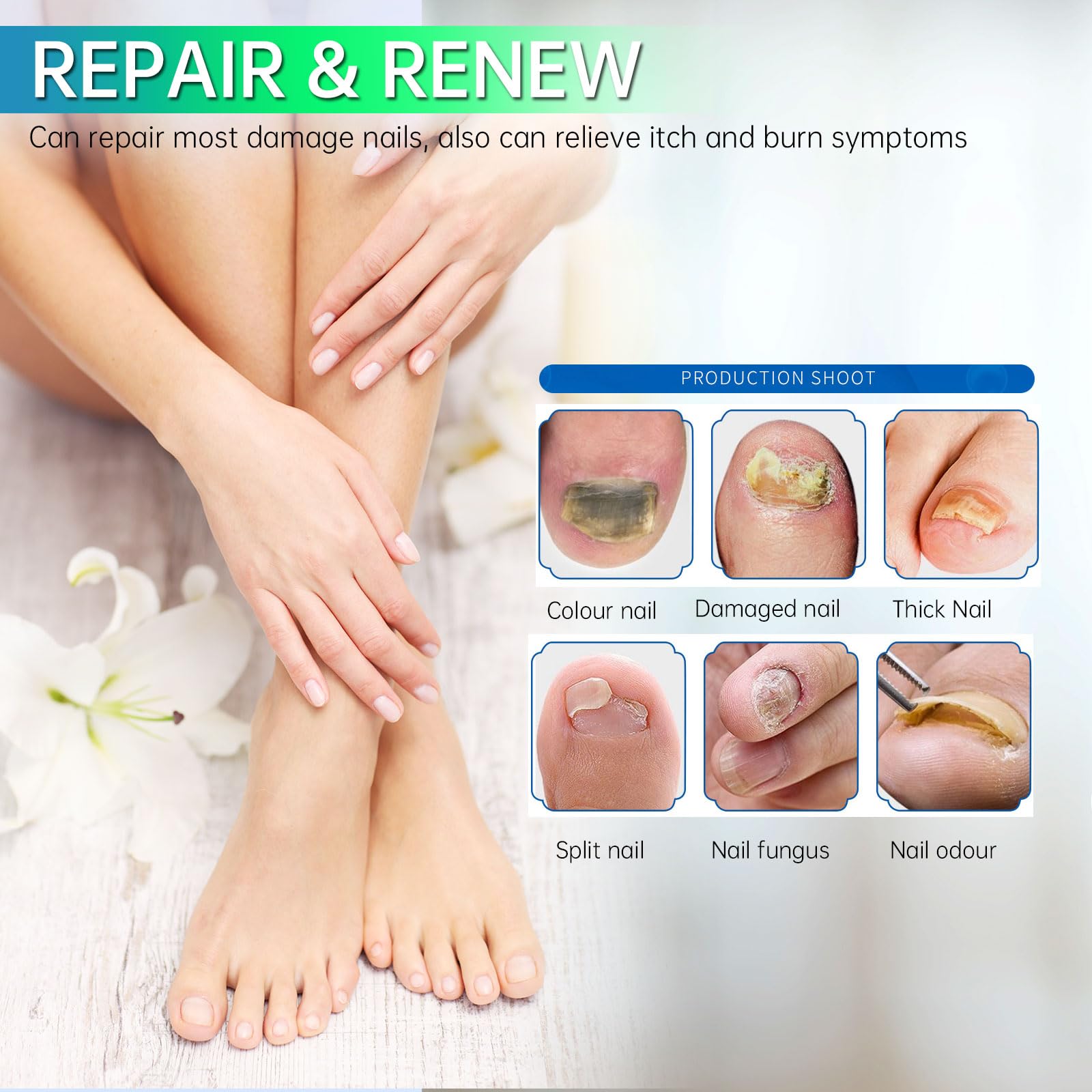 E-Bes Toenail Fungus Treatment Extra Strength, Repair Thick Color Damage Fingernail Toe Nail Fungus Treatments, Tea Tree Oil Eas