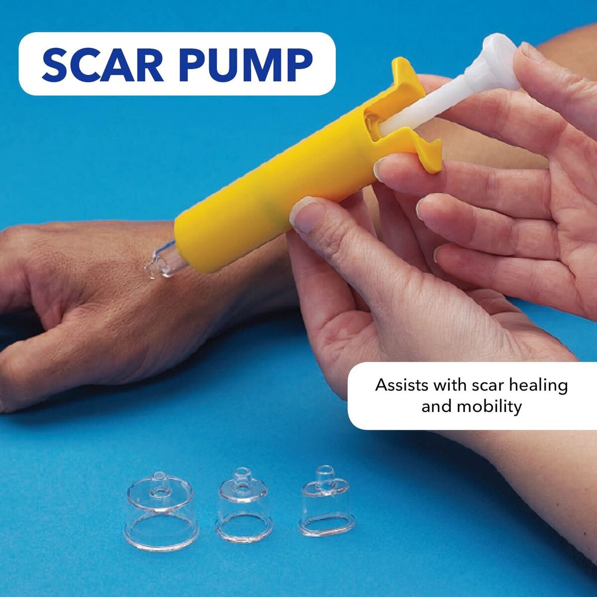 Rolyan Scar Pump, Suction Pump Assists with Lesion and Scar Healing, Tendon Repair, and Grafting, Scar Extractor Suctions Scars