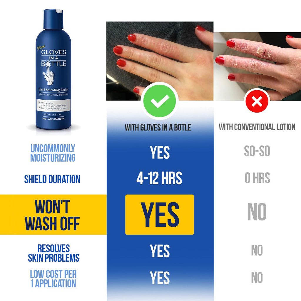 Gloves In A Bottle Psoriasis Eczema Relief Cream - Shielding Lotion for Women, Men, Baby - Cracked Hands Repair Cream - Dermatit