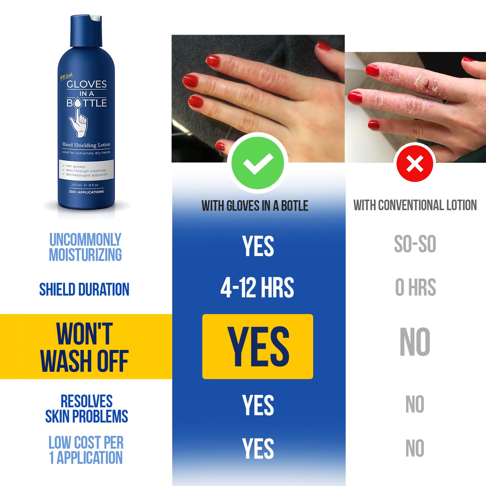 Gloves In A Bottle Psoriasis Eczema Relief Cream - Shielding Lotion for Women, Men, Baby - Cracked Hands Repair Cream - Dermatit