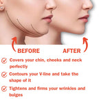 Post Surgical Chin Strap Bandage for Women Neck and Chin Compression Garment Wrap Face Straps Jowl Tightening Chin Lifting (M, B