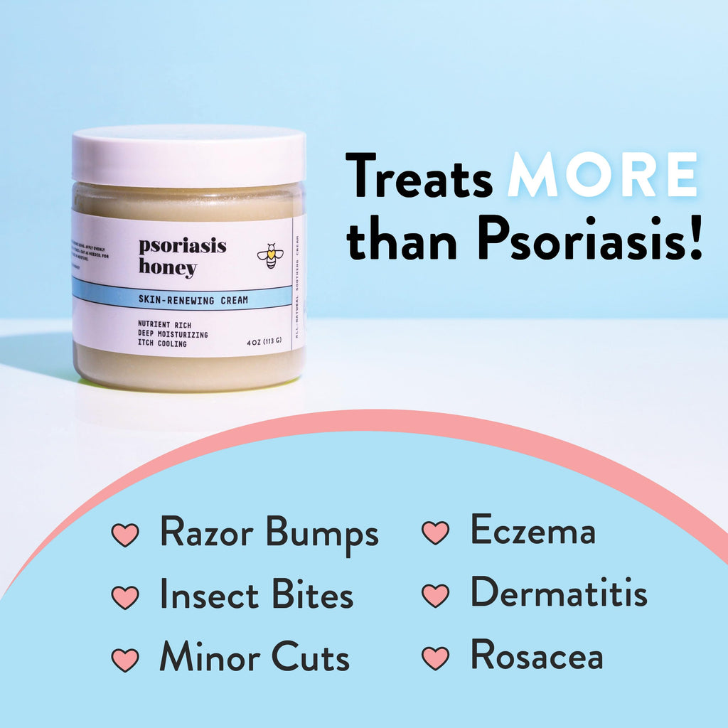 PSORIASIS HONEY Skin-Renewing Cream - Eczema & Seborrheic Dermatitis Cream - Psoriasis Treatment for Skin, Redness & Itch Relief