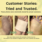 Amor Turmeric & Curcumin Topical Relief Patch - Natural Botanical Formula for Daily Comfort, Post-Workout Recovery, Muscle Soren