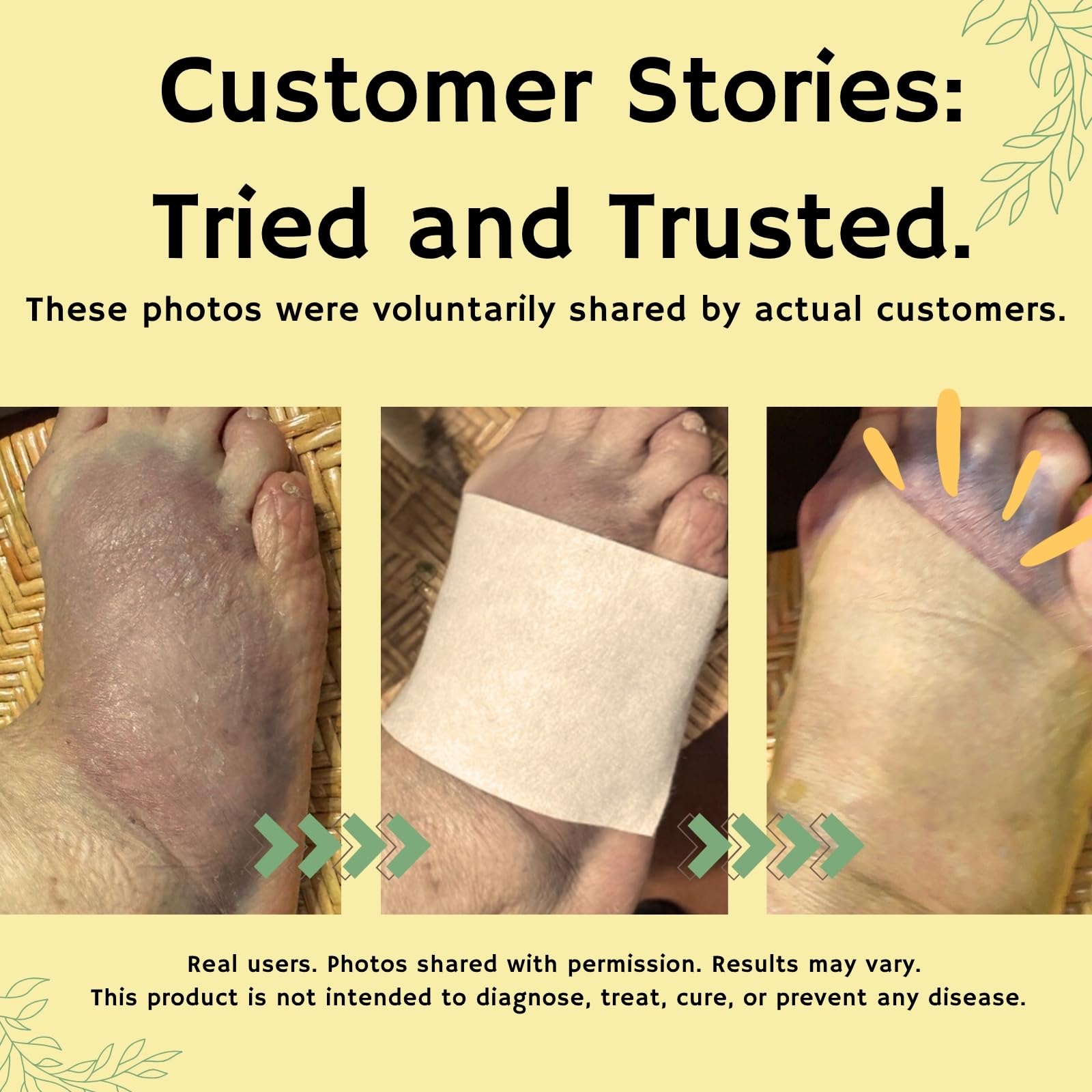 Amor Turmeric & Curcumin Topical Relief Patch - Natural Botanical Formula for Daily Comfort, Post-Workout Recovery, Muscle Soren