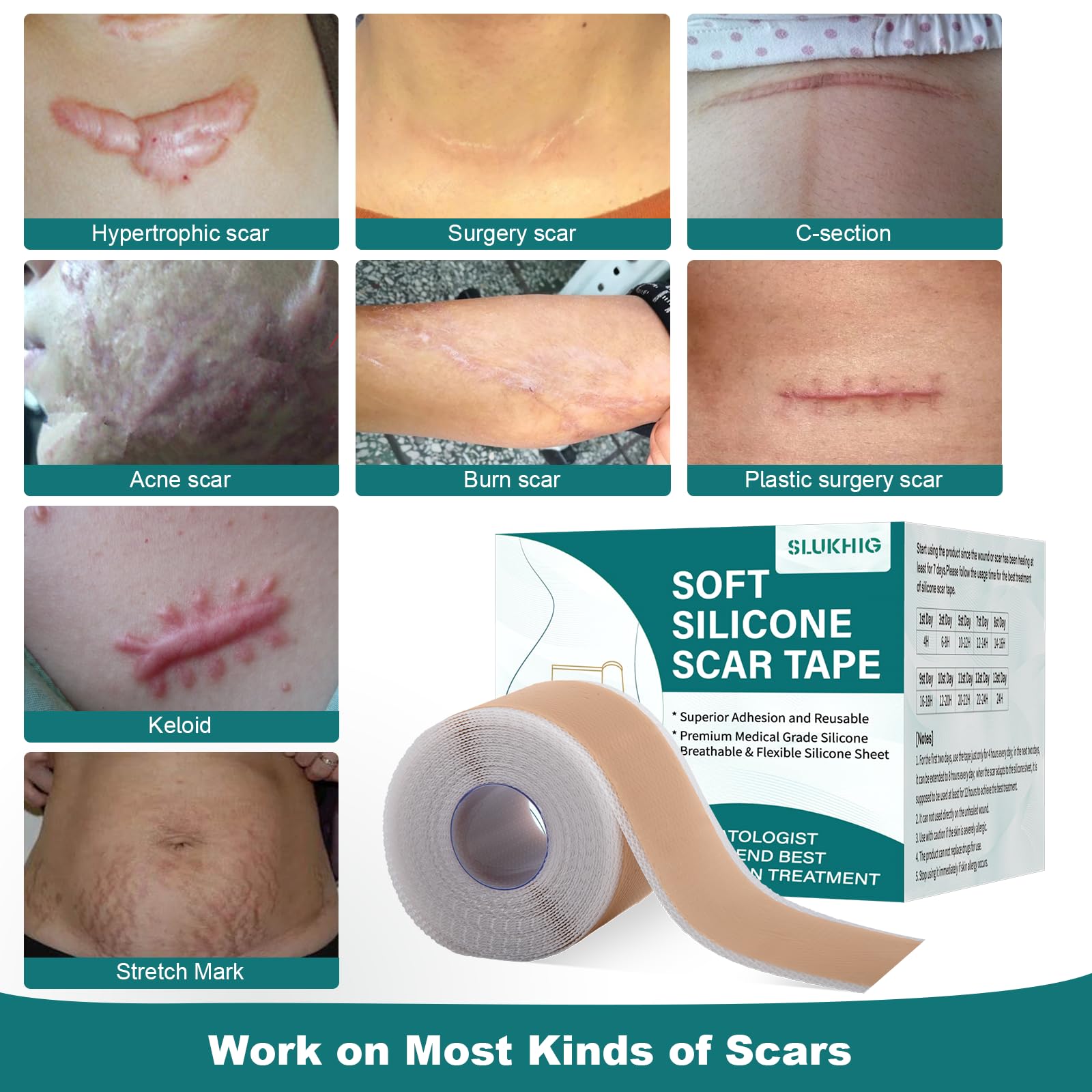 Silicone Scar Sheets (1.6''x 79'' Roll-2M), Silicone Scar Tape for Scar Removal Treatment, Reusable Silicone Scar Strips for C-S