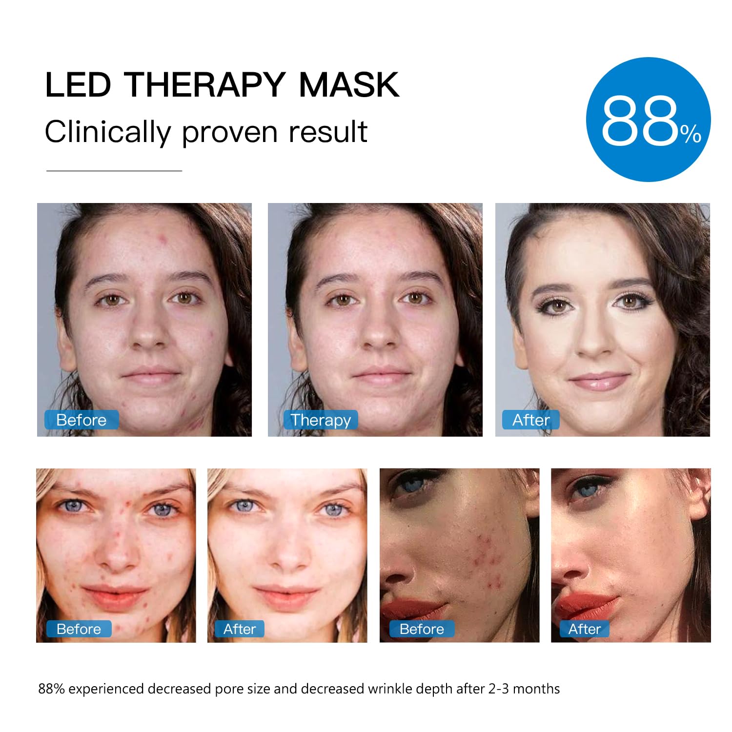 Red Light Therapy Mask for Face, Blue Red LED Light Therapy Device, 7+1 Colors LED Facial Skin Care Mask At Home, USB Rechargeab