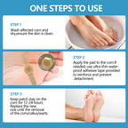 RHAICARE Corn removers for Toes feet Bottom of Foot Corn Remover,Corn Pads Callus Remover for Toes feet with 40% Salicylic 36 Co