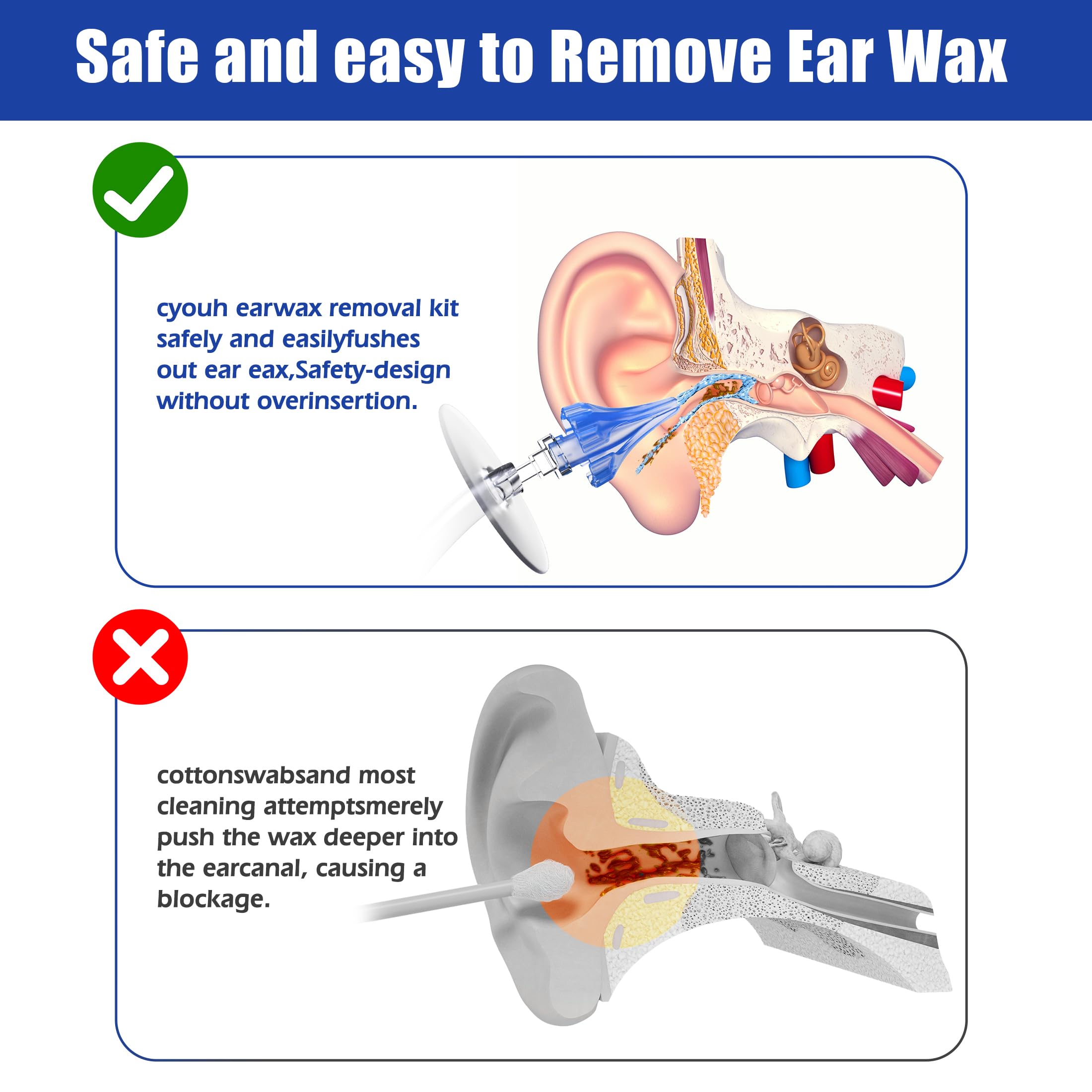 CYOUH Ear Wax Remover, Ear Cleaner, Ear Cleaning Kit, Manual Ear Wash System, Safe and Effective for Cleaning Earwax Deposits(Sa