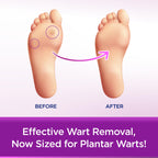 WartStick Plantar Maximum Strength Salicylic Acid Solid-Stick Plantar Wart Remover, 0.34 Oz