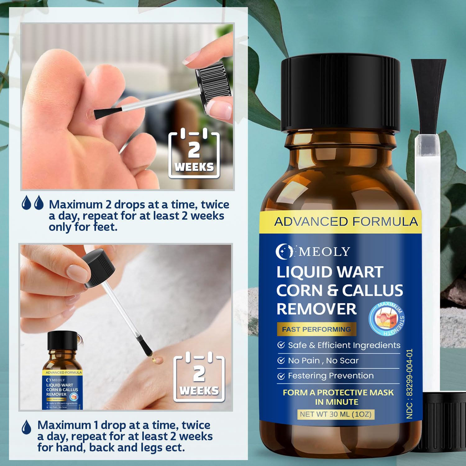 MEOLY Fast-Acting Wart Remover Freeze Off with Salicylic Acid for Plantar Warts & Corns, 30 ML, Clean, Suitable for Men and Women