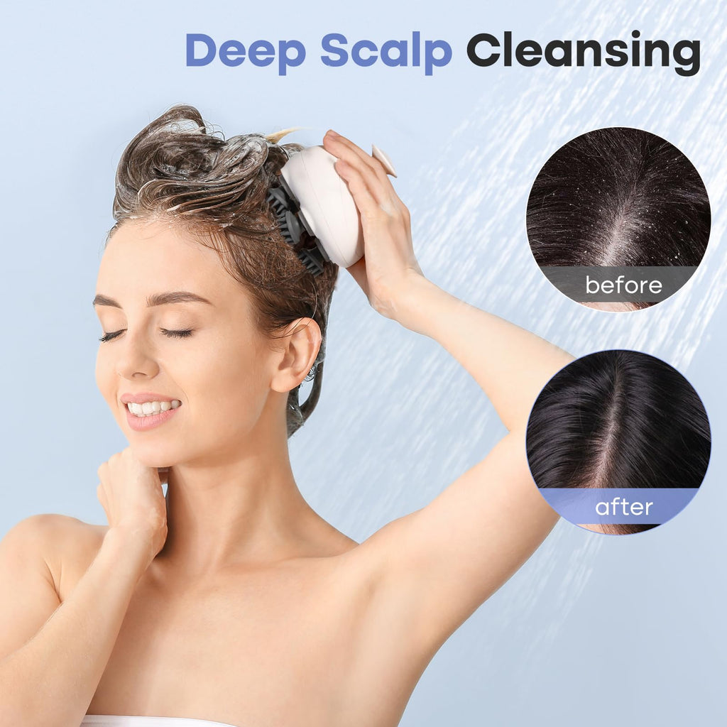 arboleaf Scalp Massager Electric Kneading Head Massager Scalp Stress Relax Portable Rechargeable Hair Massage Waterproof Cat Scr