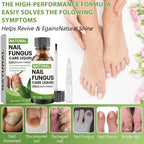 Toenail Fungus Treatment Extra Strength, Nail Fungus Treatments for Toenail with Naturally & Safely, Nail Repair Solution for Th
