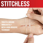 Emergency Wound Closure Strip - Laceration Closure Kit - Stitchless & Easy to Use - Butterfly Bandage