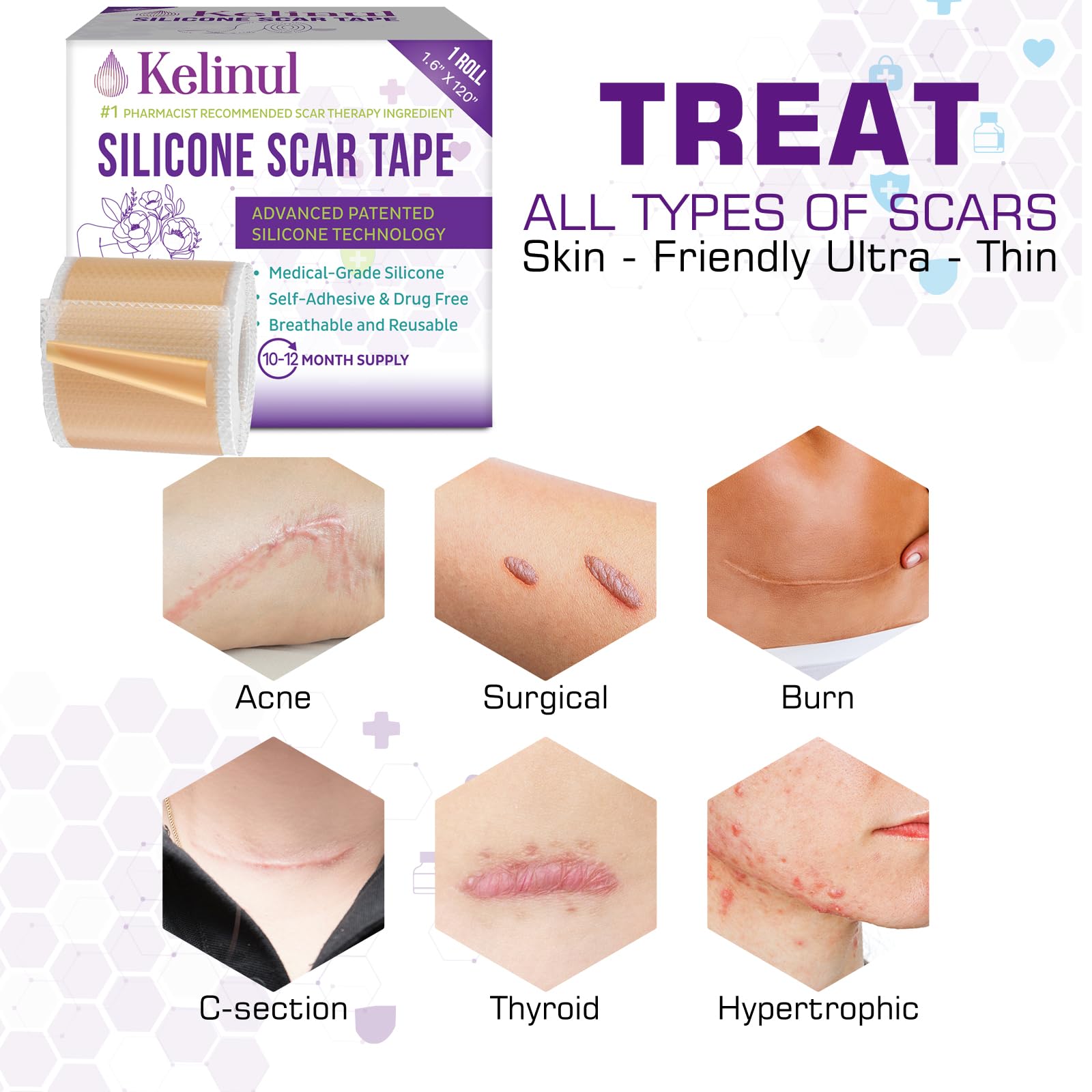 Kelinul Silicone Scar Sheets(1.6 x 120''Roll) Scar Removal Silicone Scar Tape for Softening and Flattening Scars, Acne, C-Sectio