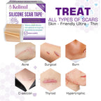 Kelinul Silicone Scar Sheets(1.6 x 120''Roll) Scar Removal Silicone Scar Tape for Softening and Flattening Scars, Acne, C-Sectio