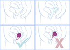 Merula Cup Galaxy (Violet) - One Size Menstrual Cup Made of Medical Silicone, 10 g