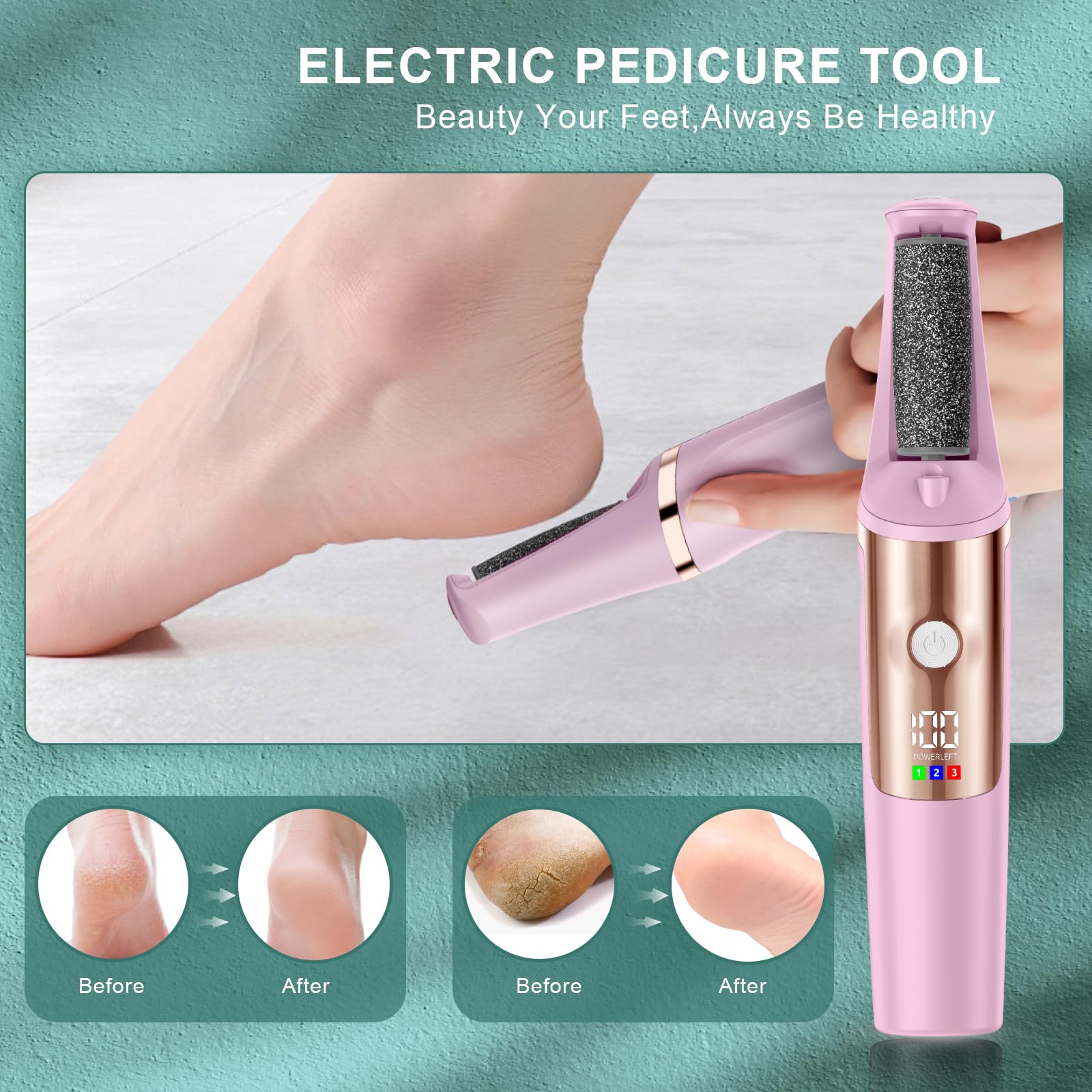 Electric Callus Remover for Feet, Professional Pedicure Tools Foot Care Kit, Foot Scrubber Electric Feet File Smooth Pedi Wand f