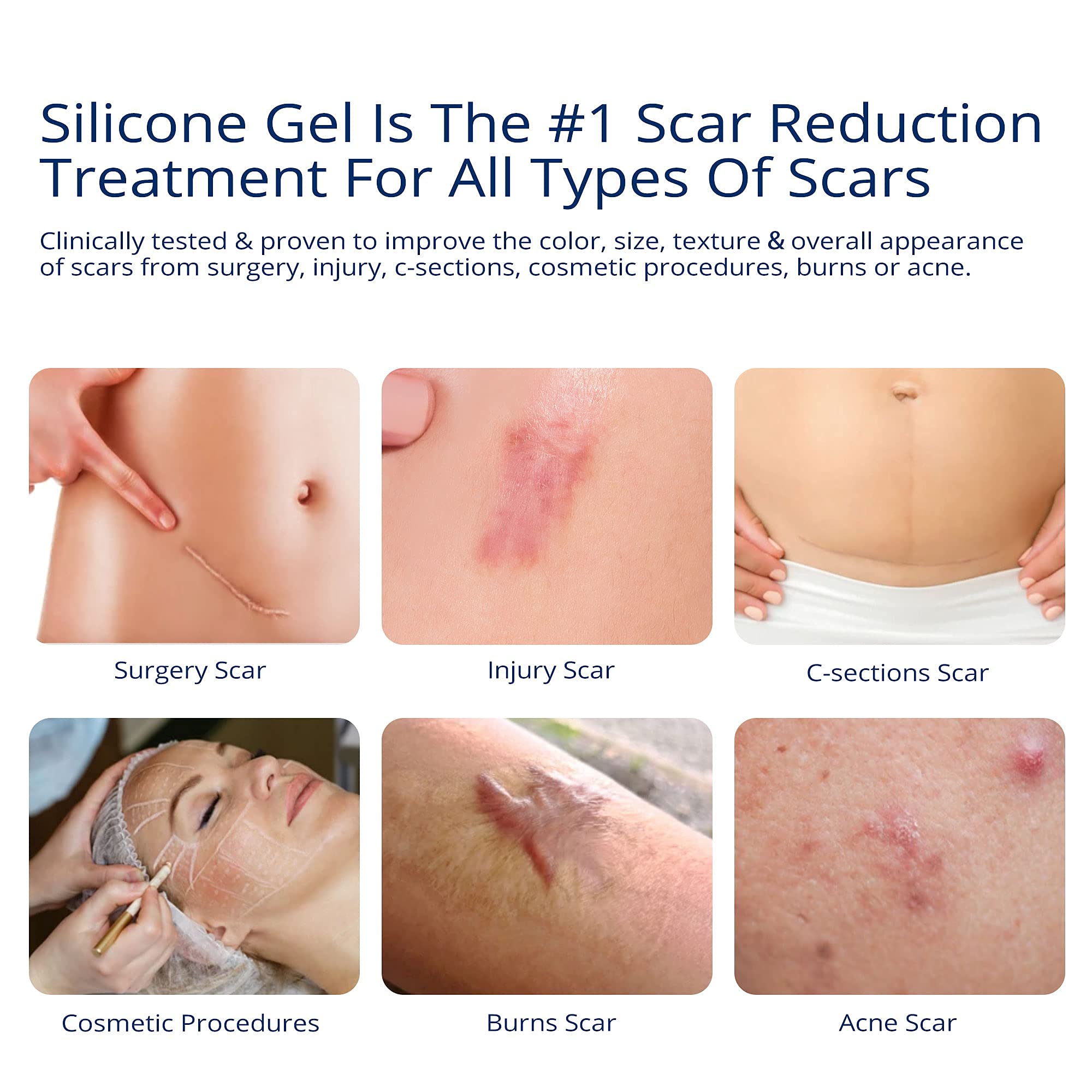 100% Silicone Scar Gel Scar Cream - Advanced Scar Gel for Surgical Scars, C-Section, Stretch Marks, Acne, Injury, Burns, Keloids