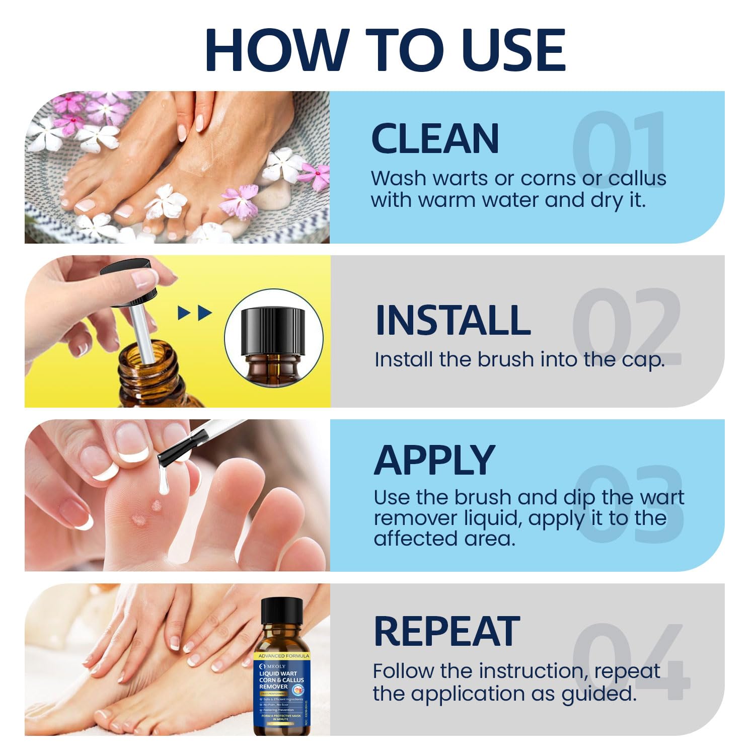 MEOLY Fast-Acting Wart Remover Freeze Off with Salicylic Acid for Plantar Warts & Corns, 30 ML, Clean, Suitable for Men and Women