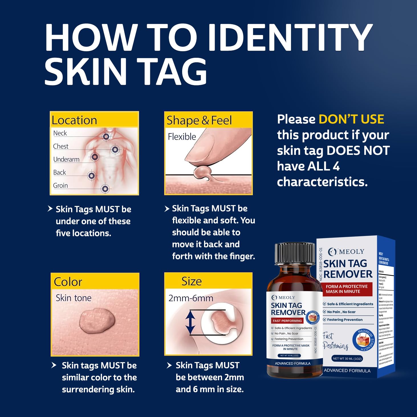 MEOLY Skin Tag Remover: Skin Tag Remover with Salicylic Acid for Men and Women 30 ML