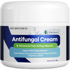 Charmpoo Antifungal Cream for Jock Itch: 2% Miconazole Anti Fungal Cream for Itchy Skin Relief Extra Strength - Ringworm Treatme