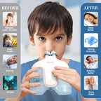 Nasal Irrigation System with 50 Salt Packets (Blue), Sinus Rinse Machine, Nose Cleaner for Sinus Adult, Nose Washer Nasal Rinsin