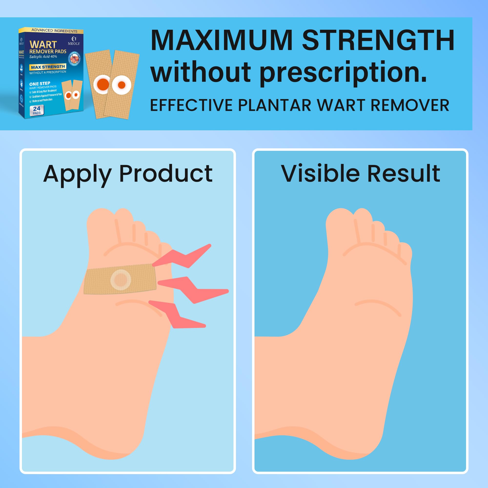 MEOLY Plantar Wart Remover Pads: Salicylic Acid Wart Remover Bandaid for Plantar Wart, Hand Wart, Corns, Callus Removal with 40%