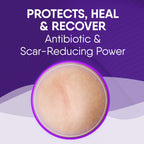 Cicatricure Skin Recovery Kit: Advanced Scar Gel & Open Wound Care Antibiotic Ointment, Reduces Stretch Marks, Surgical & Acne S