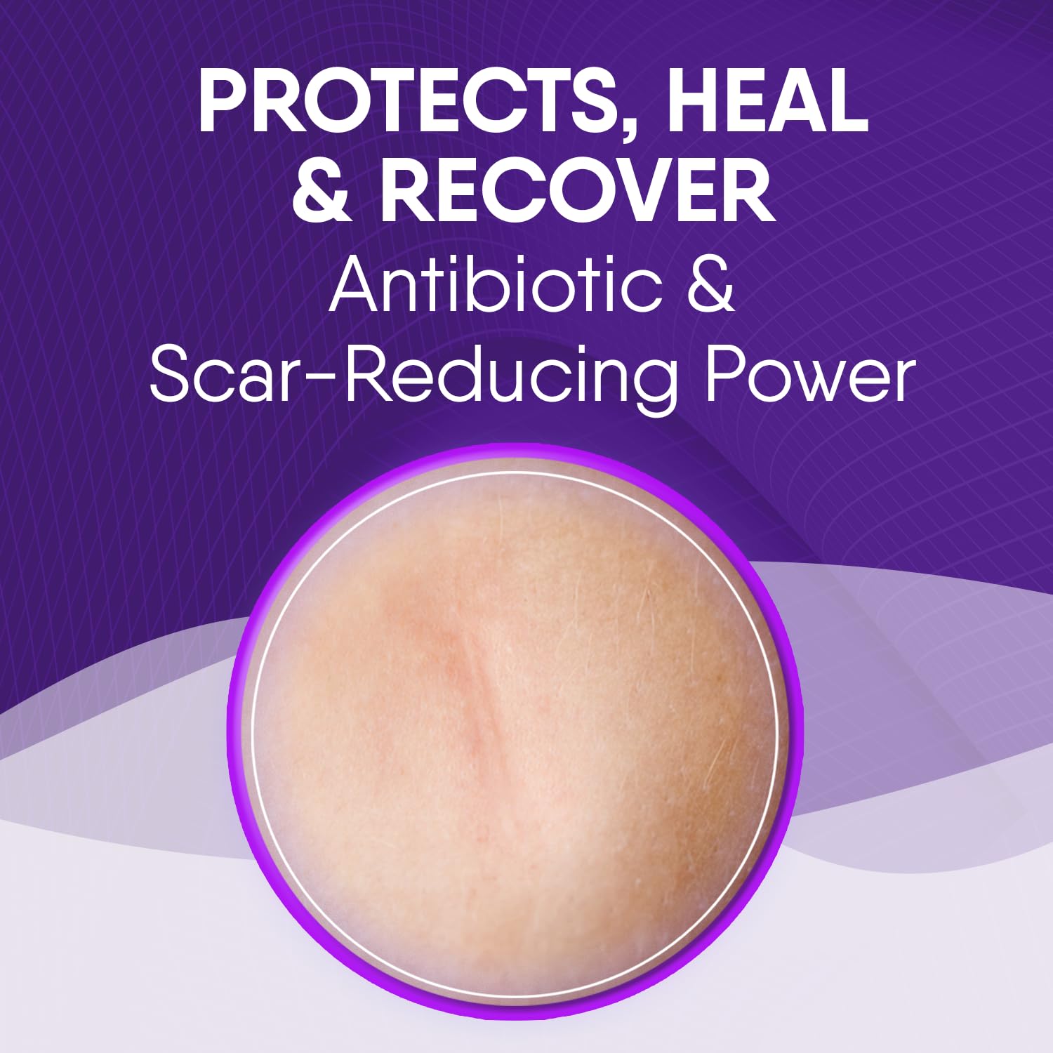 Cicatricure Skin Recovery Kit: Advanced Scar Gel & Open Wound Care Antibiotic Ointment, Reduces Stretch Marks, Surgical & Acne S