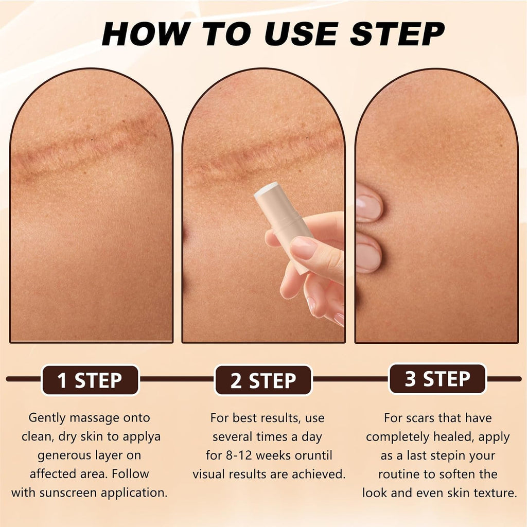2pcs Silicone Scar Stick, Made of 60% Silicone,Gentle on All Skin Types