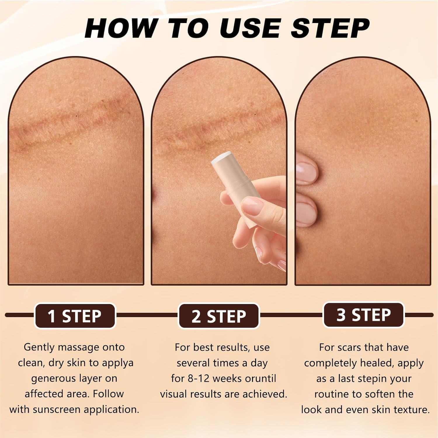 2pcs Silicone Scar Stick, Made of 60% Silicone,Gentle on All Skin Types