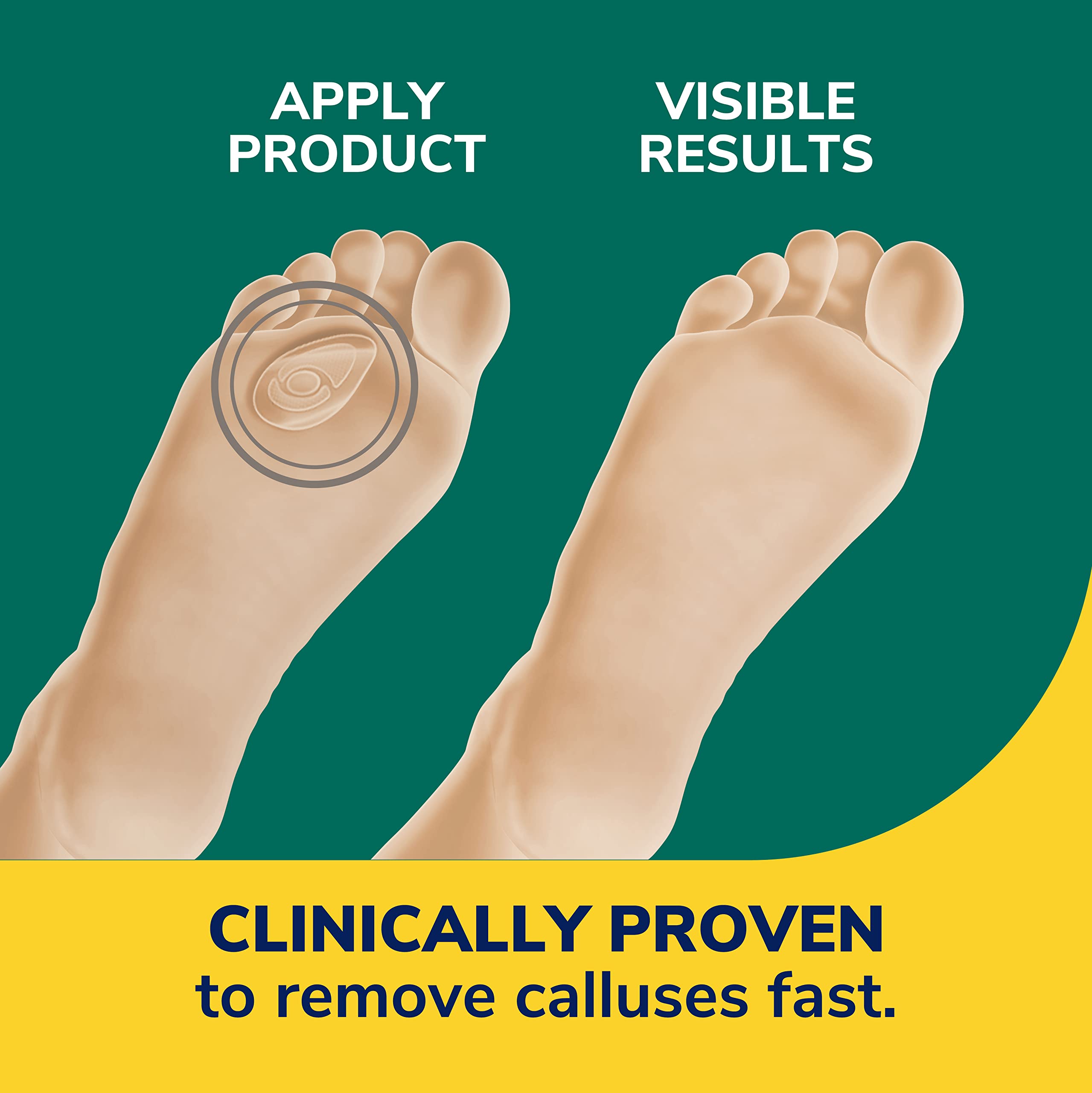 Dr. Scholl's Duragel Callus Remover 12 Count