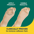 Dr. Scholl's Duragel Callus Remover 12 Count