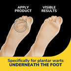 Dr. Scholl's Plantar WART Remover HYDROGEL Bandage 12 Discs 10 Cushions, Immediate Cushioning Pain Relief, Ultra-Thin, Maximum S