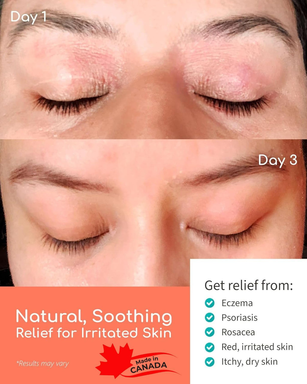 Organic Manuka Skin Soothing Cream for Sensitive Dry Skin, Original Formula, Itch Relief, Honey Eczema Relief, Natural Psoriasis
