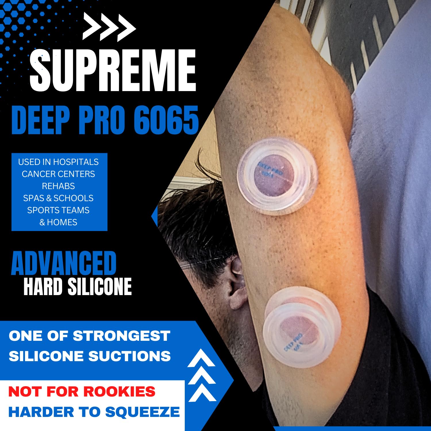 Cupping Warehouse Advanced Supreme 2 Small DEEP PRO 6065 Professional Cupping Therapy Set- Myofascial Cupping Set- Professional