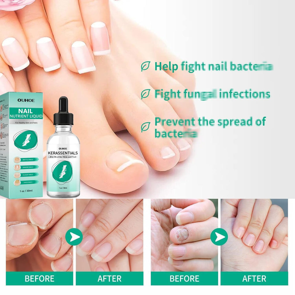 Kerassentials Nails Nutrient Oil,Kerassentials Toenail Oil,Nail Repair Solution,Nail Renewal Liquid For Damaged & Discoloration