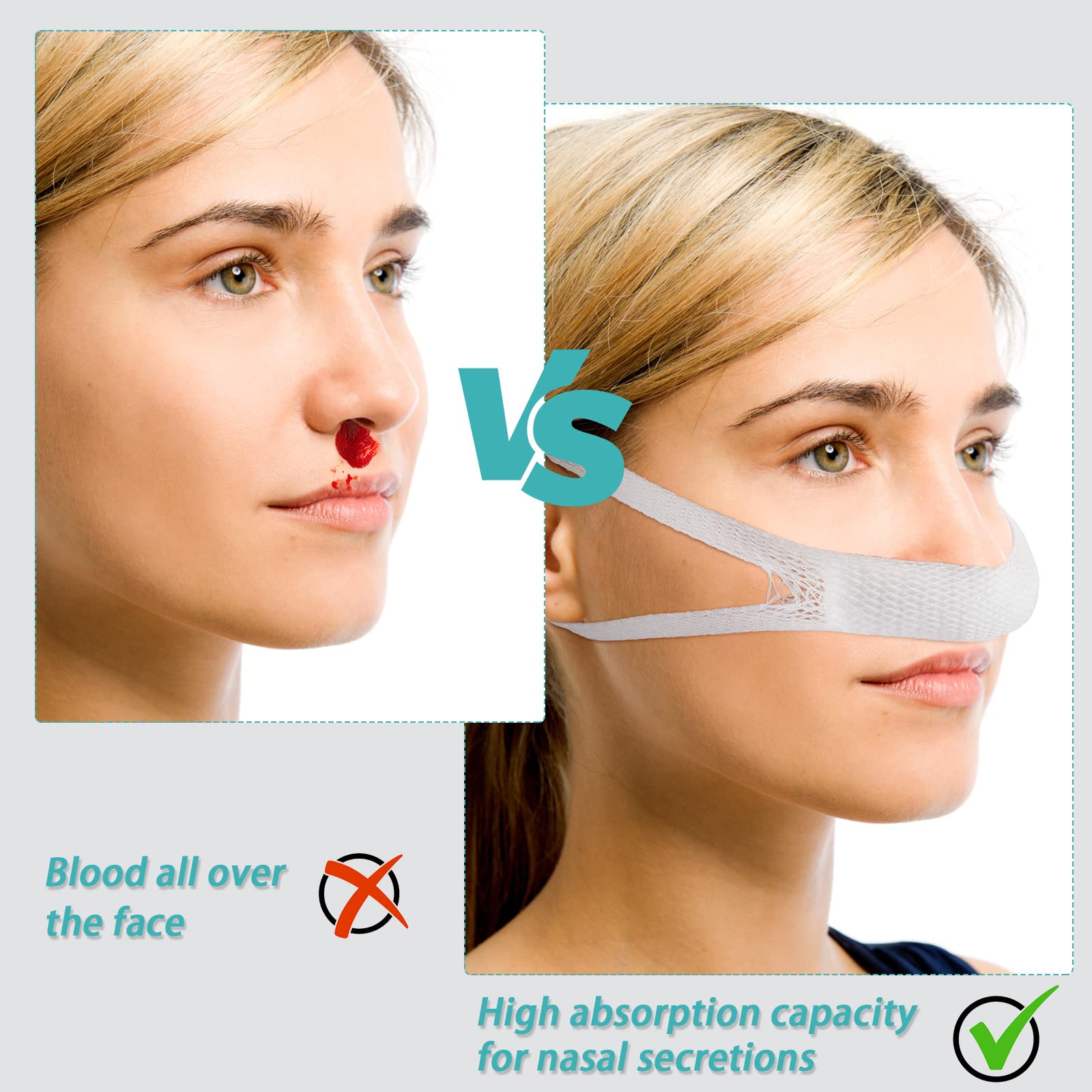 Patelai Elastic Nose Bandage, External Nasal Bandage Dressing Holder with High Absorption Capacity for Nose, White(20 Pcs)