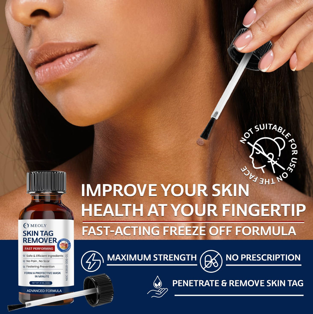 MEOLY Skin Tag Remover: Skin Tag Remover with Salicylic Acid for Men and Women 30 ML